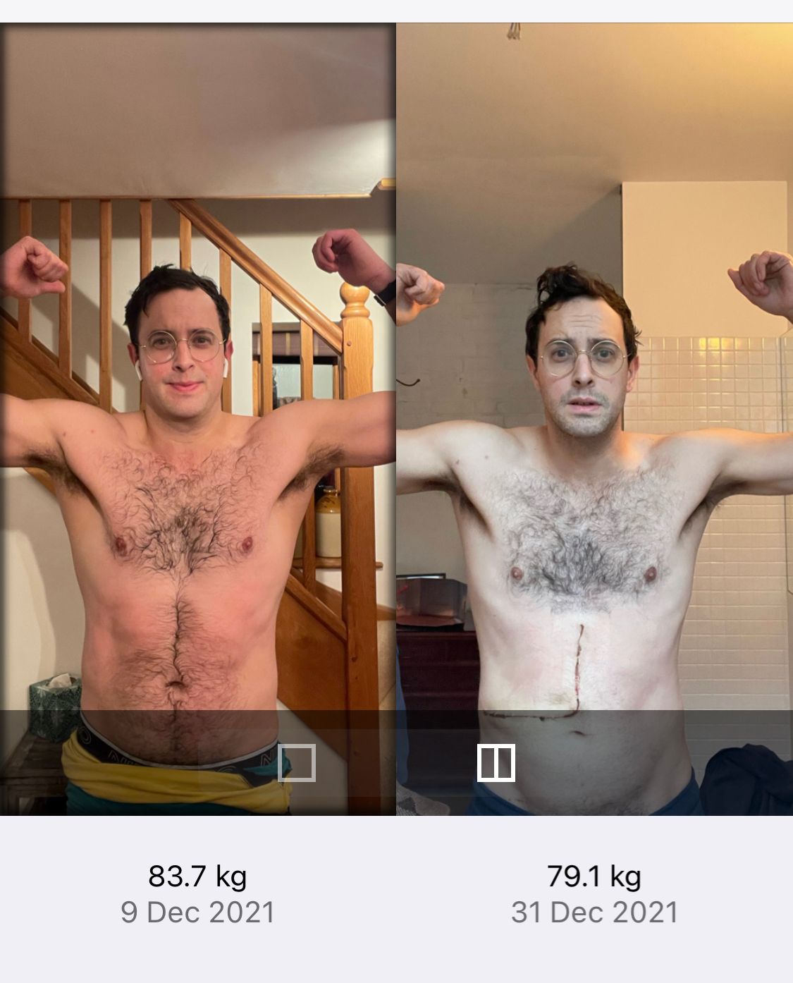 _Before_the_op_and_after