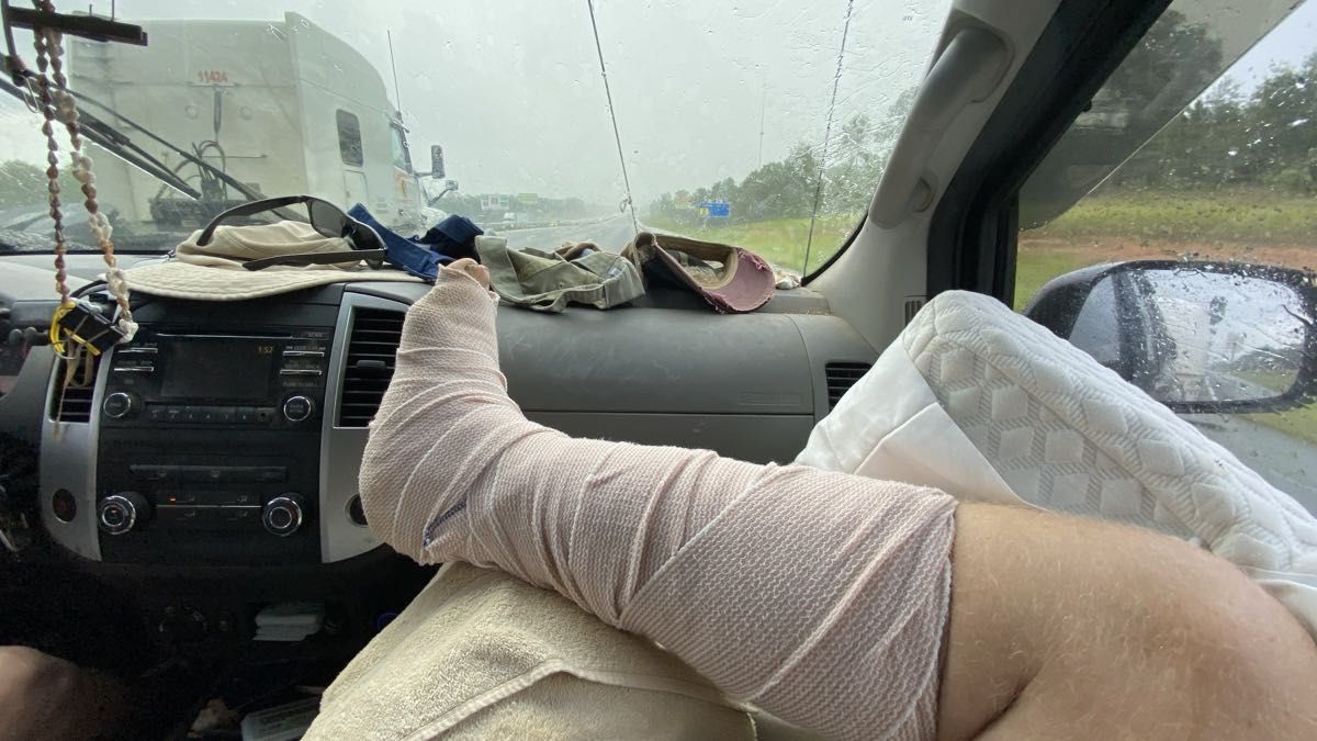 _images/boken_ankle_drive_home.jpg