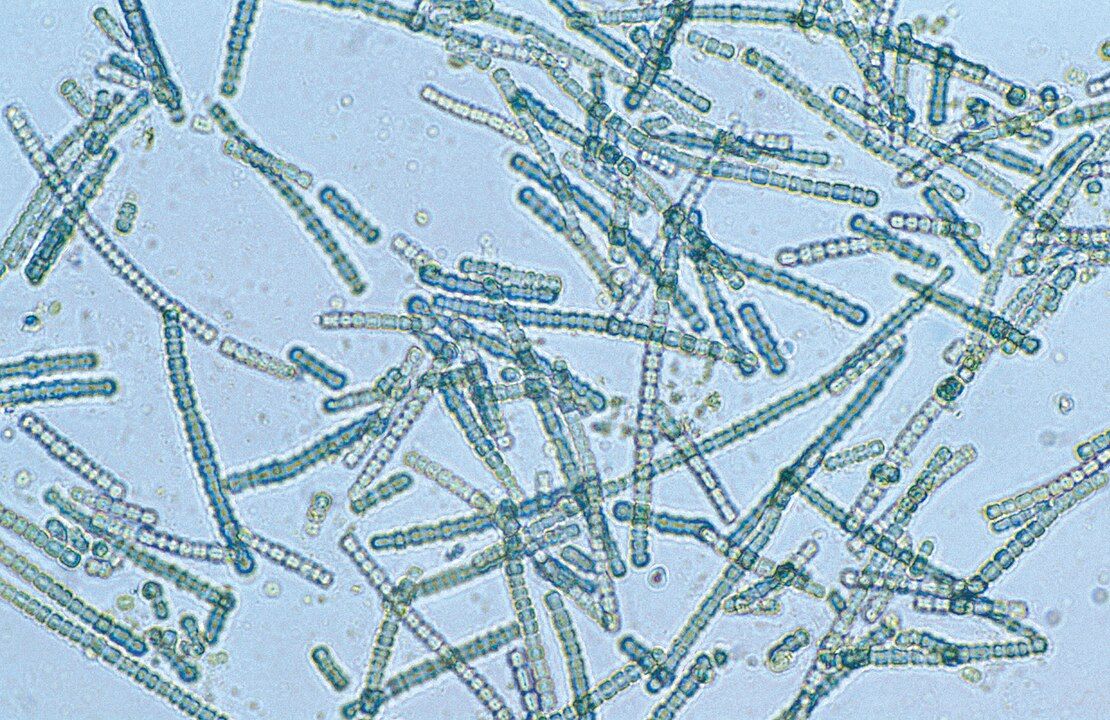 Cyanobactéries (selfie) – ©Wikimedia