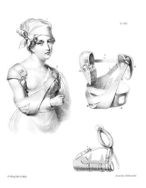 A woman is wearing her arm in a sling as diagrams of bandages and slings can be seen depicted on the same page.