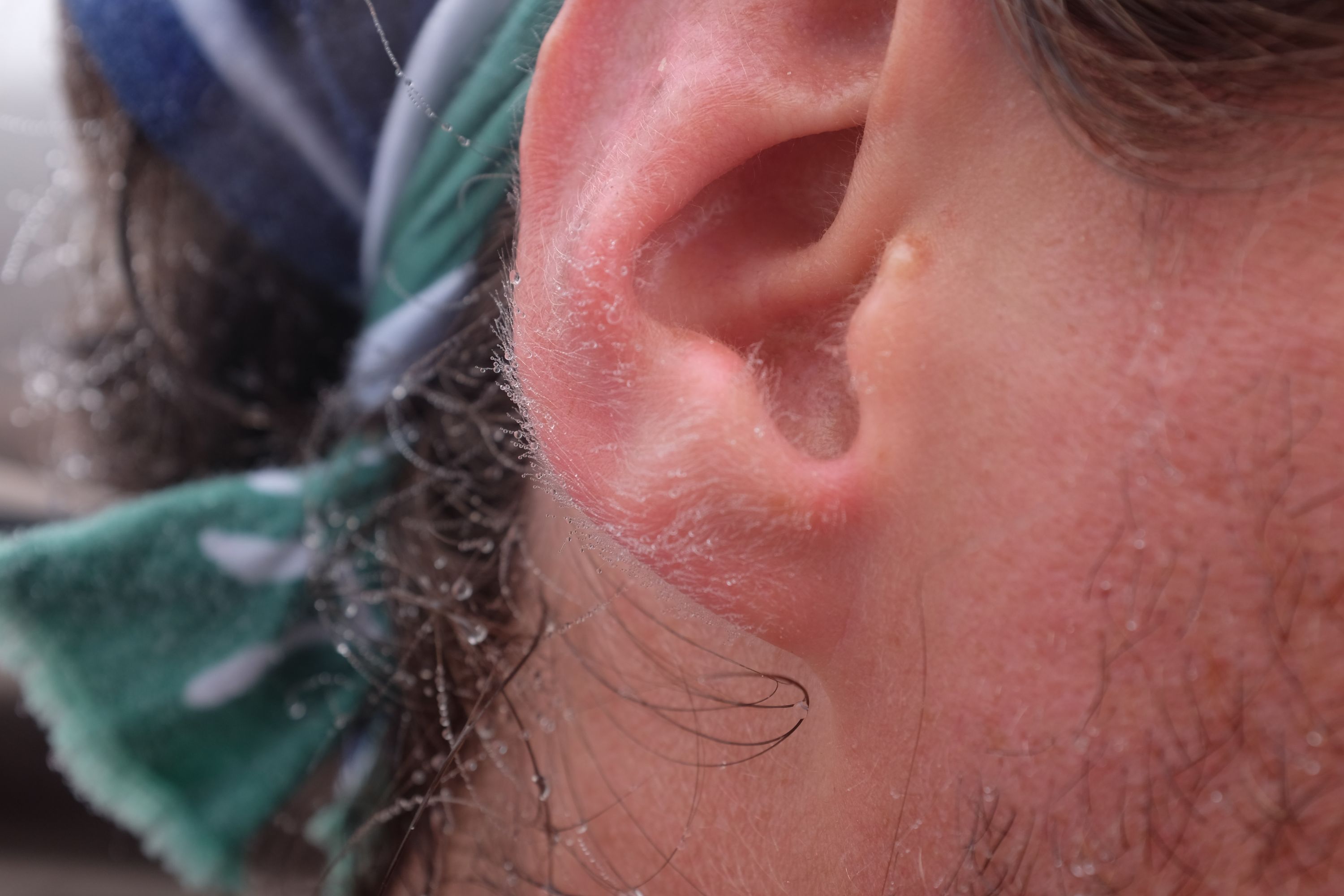 Closeup of the fine hairs on Gabor’s ears covered in dew.